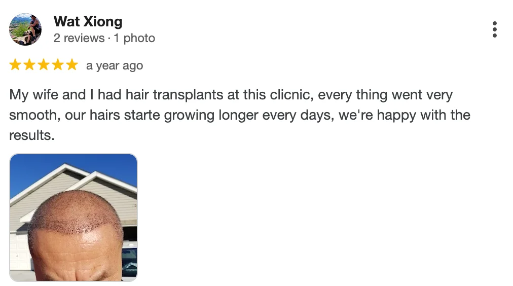 Hair Transplant In Turkey with Hestanbul - Reviews -