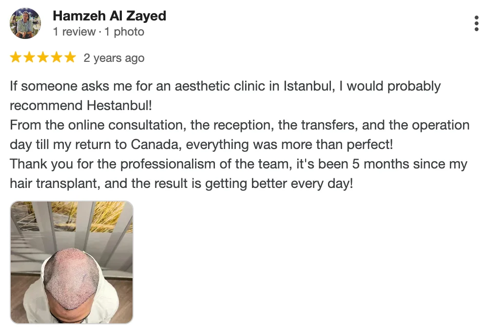 Hestanbul Hair Transplant In Turkey - Review