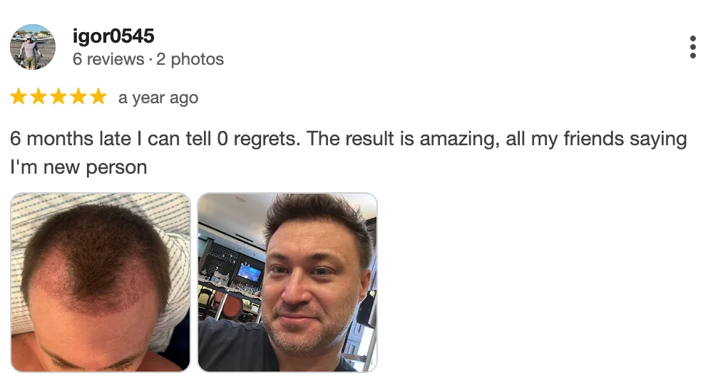 Hestanbul-Hair-Transplant-in-Turkey-Reviews -