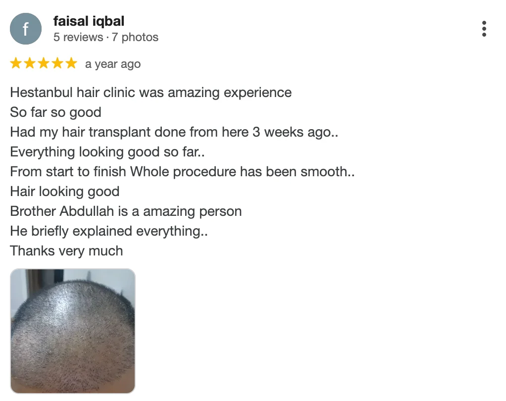 Hestanbul-Hair-Transplant-in-Turkey-Reviews-